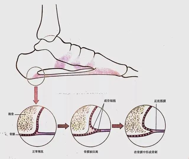 想知道自己的膝盖是好是坏？三个动作自测！