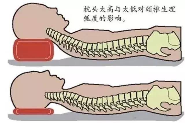 非遗老张家膏贴：有颈椎病就不能看手机吗？